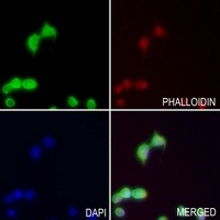Anti-TRIP13 Antibody
