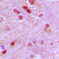 GTF3C3 Antibody