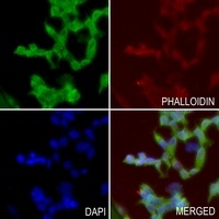 B4GALT5 antibody