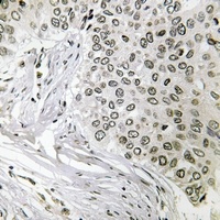 Anti-SNRP116 Antibody
