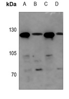UBE4A Antibody