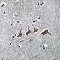 Anti-PAHT Antibody