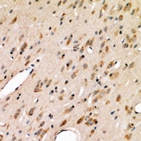 Anti-ABCG2 Antibody