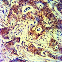 NKp46 antibody