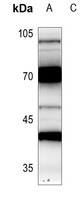 CRSP7 Rabbit Polyclonal Antibody