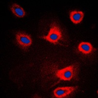 PERK Antibody