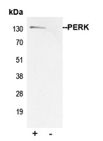 PERK Antibody