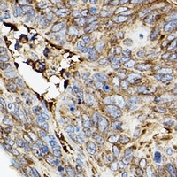 Anti-ROCK2 Antibody