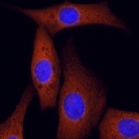 Anti-ROCK2 Antibody