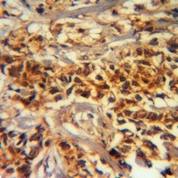 Anti-ADAMTS2 Antibody