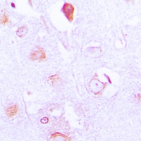 Anti-FXR2 Antibody