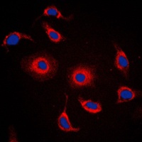 Anti-FXR2 Antibody