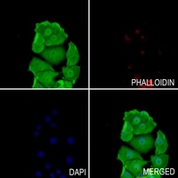 BAGE5 Antibody