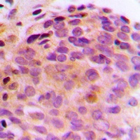 Anti-BAG4 Antibody