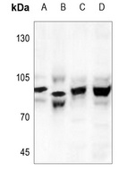 CHD1L Antibody
