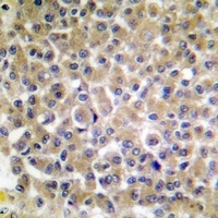 Anti-p130 Cas (Phospho-Y249) Antibody