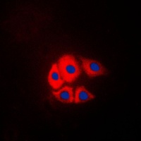 Anti-p130 Cas (Phospho-Y249) Antibody