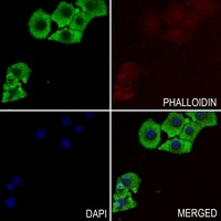 Anti-RIN1 Antibody