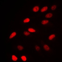 NCOR1 antibody