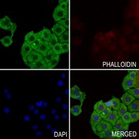 Anti-ABCG1 Antibody