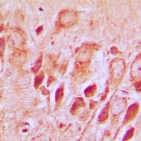 Anti-Synphilin 1 Antibody