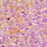 Anti-Nephrocystin 5 Antibody