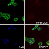 Anti-Nephrocystin 5 Antibody