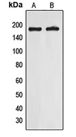 EIF5B Antibody