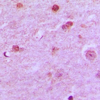 Anti-N4BP1 Antibody