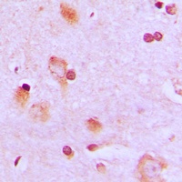 CEP57 antibody