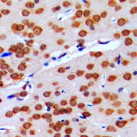 Anti-GPRIN2 Antibody