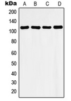 Histone Deacetylase 9 Antibody