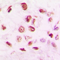 Anti-Histone Deacetylase 9 Antibody