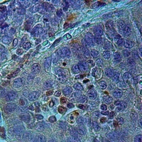 Anti-RASSF2 Antibody