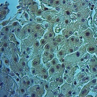 Anti-GFR Antibody