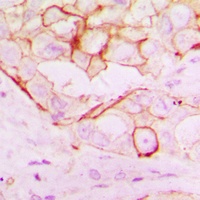 Anti-RNF144A Antibody