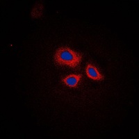 Anti-RNF144A Antibody