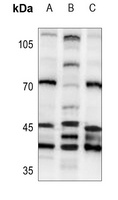 PSMD6 Antibody