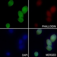 Anti-ZC3H11A Antibody