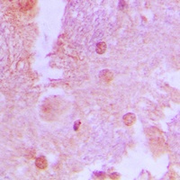 Anti-AS160 (Phospho-T642) Antibody
