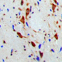 Anti-SMG7 Antibody