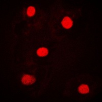 NICE4 Rabbit Polyclonal Antibody