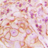 Anti-GPR105 Antibody