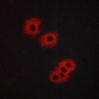 Anti-GPR105 Antibody