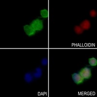 Anti-OXSR1 Antibody