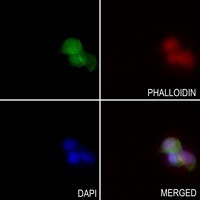 Anti-FGF19 Antibody