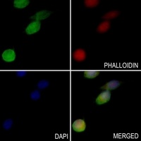 Anti-ABI1 Antibody