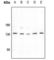 Histone Deacetylase 6 Rabbit Polyclonal Antibody