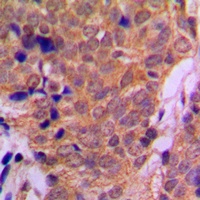 HDAC6 antibody