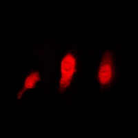 Anti-Histone Deacetylase 6 Antibody